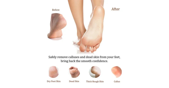 La Palm Extreme Callus Remover - French Rose (1Gal)