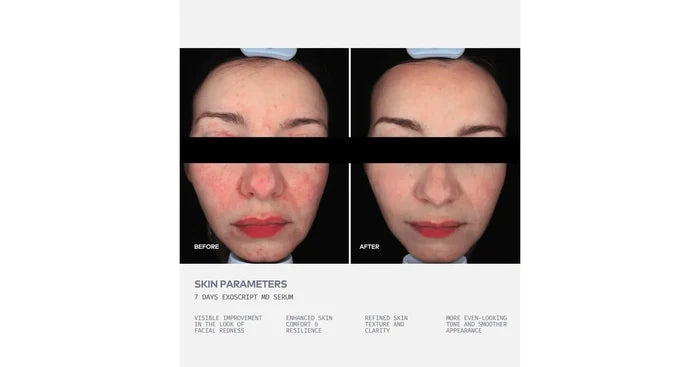 ADOREYES ExoScript MD™ Biomimetic Renewal Face Serum (20 ml)