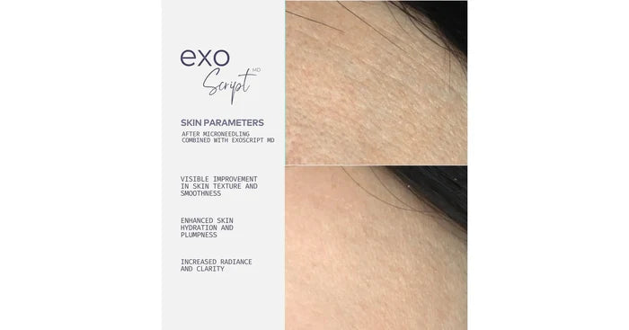 ADOREYES ExoScript MD™ Biomimetic Renewal Face Serum (20 ml)