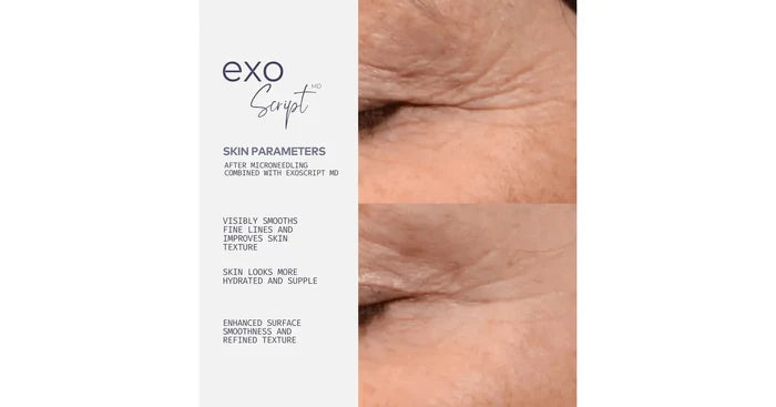 ADOREYES ExoScript MD™ Biomimetic Renewal Face Serum (20 ml)