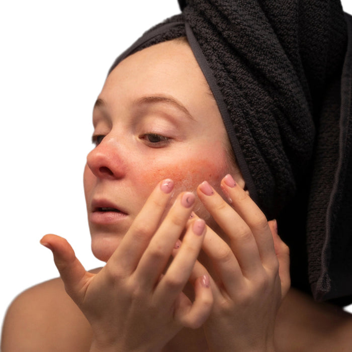 white woman black head towel red cheeks dermal essentials medical grade skincare