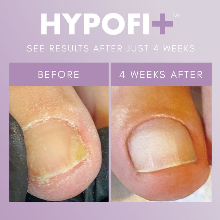 HypoFix™ Repair Serum 20ML
