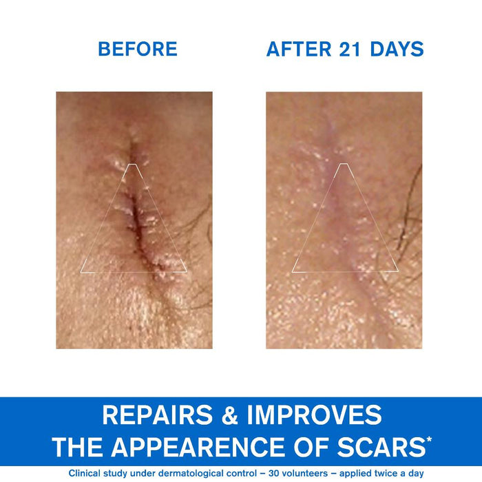 Uriage Bariederm Repairing Cica-Cream 100ml
